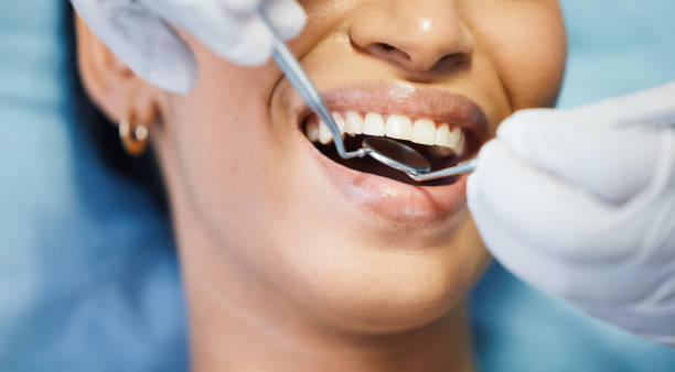 Best Emergency Cosmetic Dentistry in Crested Butte, CO
